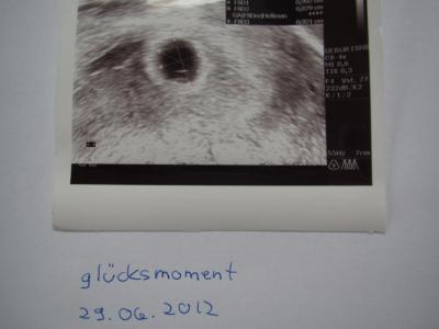 Bild zu Vorbei... - Kinderwunsch - bitte noch ein Baby