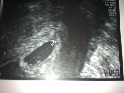 Bild zu War heute bei meiner Frauenärztin :) - Kinderwunsch - bitte noch ein Baby