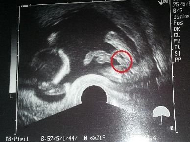 Bild zu Ich bekomme einen Neffen :-))) - Kinderwunsch - bitte noch ein Baby