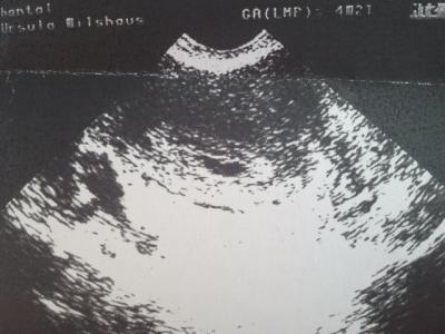 Bild zu Neu hier und unsicher was ich jetzt denken soll... - Kinderwunsch - bitte noch ein Baby