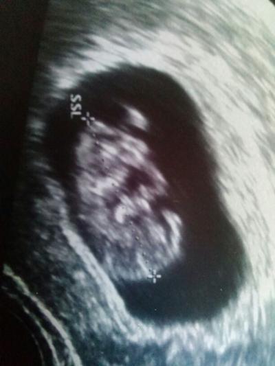 Bild zu an blume - Kinderwunsch - bitte noch ein Baby