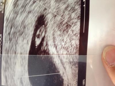 Bild zu Nur an die die es interessiert möchte niemanden ärgern! - Kinderwunsch - bitte noch ein Baby