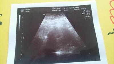 Bild zu bildchen - Kinderwunsch - bitte noch ein Baby