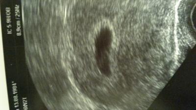 Bild zu Wollte mal Hallo sagen!!!! - Kinderwunsch - bitte noch ein Baby