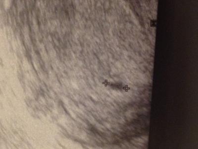 Bild zu Puuuuuuuussssssstttttttt - Kinderwunsch - bitte noch ein Baby
