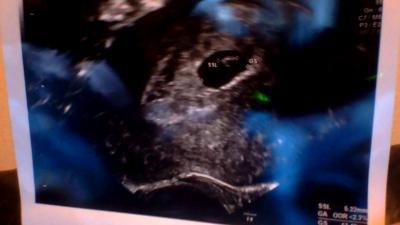 Bild zu Hallo ihr Lieben- hier ein Bildchen hoffe ist erkennbar - Kinderwunsch - bitte noch ein Baby