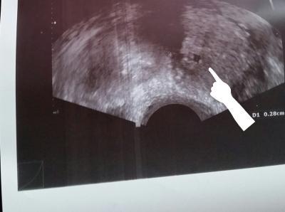 Bild zu Schwanger, nicht schwanger? - Kinderwunsch - bitte noch ein Baby