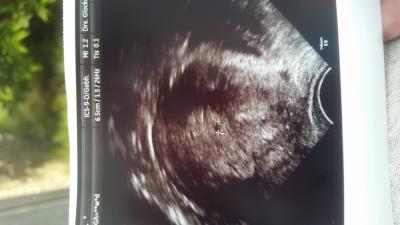 Bild zu könnt ihr bitte mal kucken.... Bild bei 5+0 - Kinderwunsch - bitte noch ein Baby