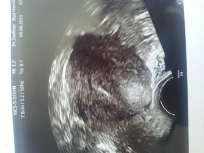 Bild zu Woher diese Skepsis........WOHER BLOSS.......könnt nur heulen. - Kinderwunsch - bitte noch ein Baby