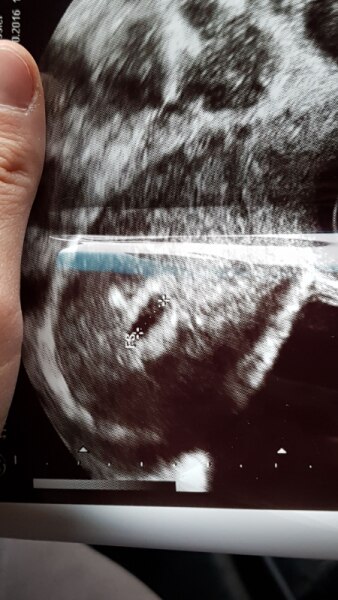 Bild zu Wahrscheinlich wieder da.? Abort 5ssw :( - Kinderwunsch - bitte noch ein Baby