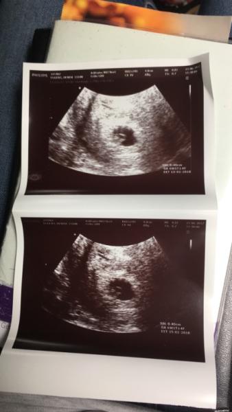 Bild zu Das erste Foto - Kinderwunsch - bitte noch ein Baby