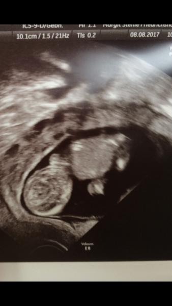 Bild zu Vielen Dank - Kinderwunsch - bitte noch ein Baby