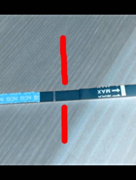 Bild zu Dunkle Linie auf Test ist das eine VL? - Kinderwunsch - bitte noch ein Baby