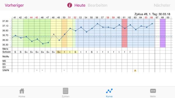 Bild zu Gelbkörperzyste? - Kinderwunsch - bitte noch ein Baby