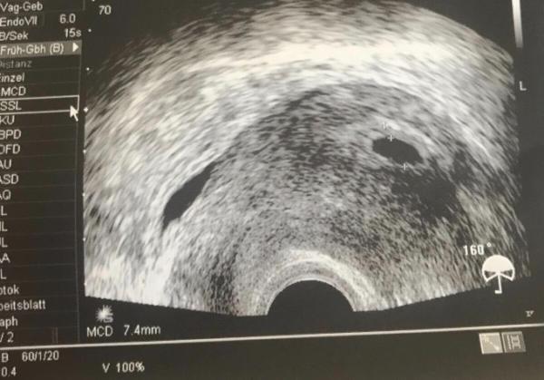 Bild zu Verwirrung Pur - Kinderwunsch - bitte noch ein Baby