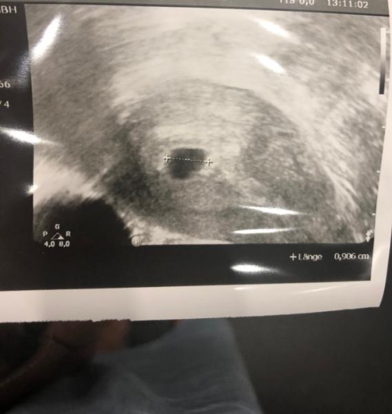 Bild zu Mulmiges Gefühl - Kinderwunsch - bitte noch ein Baby