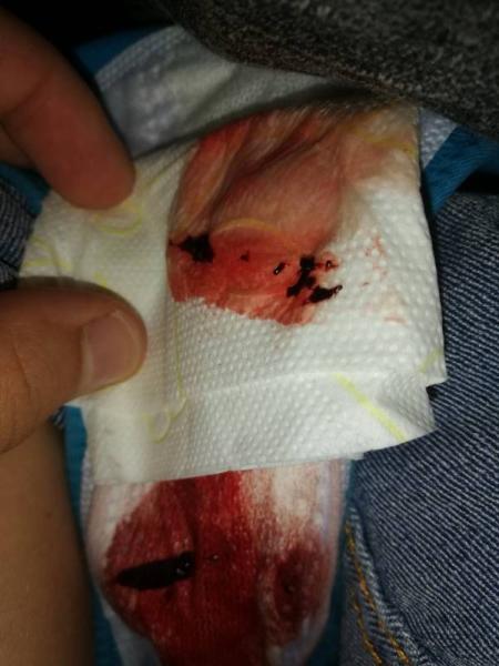 Bild zu Hilfe Achtung ecklig Mit Foto - Kinderwunsch - bitte noch ein Baby