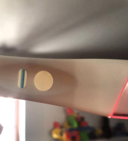 Bild zu ES+13 sehe nur ich den Schatten? 😁 - Kinderwunsch - bitte noch ein Baby