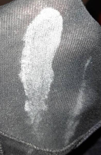 Bild zu Ausfluss extrem trocken - Kinderwunsch - bitte noch ein Baby