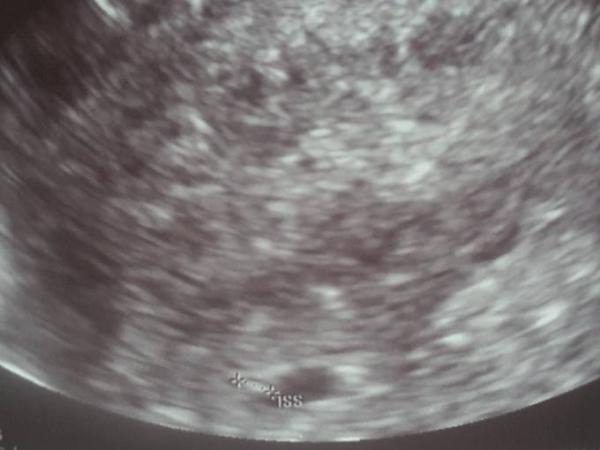Bild zu Hallo mädels doch positiv - Kinderwunsch - bitte noch ein Baby