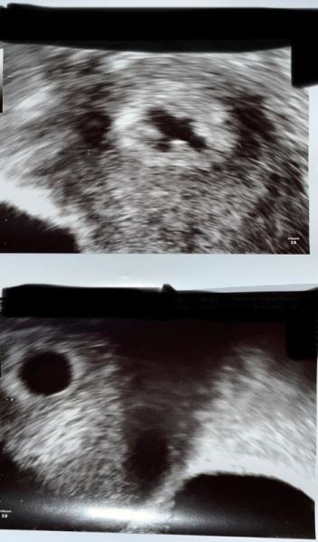 Bild zu Eure Meinung wird gebeten - Kinderwunsch - bitte noch ein Baby