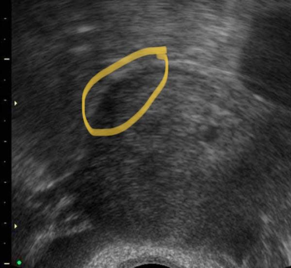 Bild zu Schwangerschaft? Brauche Rat - Kinderwunsch - bitte noch ein Baby