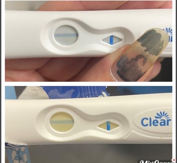Bild zu Gibt es eine Verdunstungslinie? - Kinderwunsch - bitte noch ein Baby