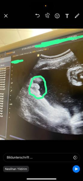Bild zu Brauche euren rat ist das ein Mädchen oder eher ein junge bitte um Hilfe - Kinderwunsch - bitte noch ein Baby