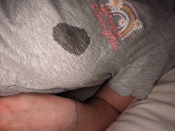 Bild zu Milchaustritt SS Zeichen - Kinderwunsch - bitte noch ein Baby