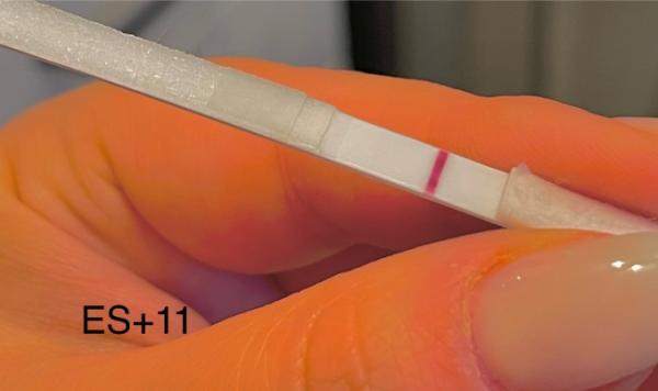 Bild zu SS Anzeichen Test ganz leicht positiv? - Kinderwunsch - bitte noch ein Baby
