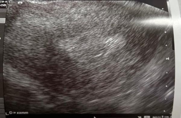 Bild zu Was meint ihr? Schwanger? - Kinderwunsch - bitte noch ein Baby