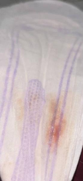 Bild zu Einnistungsblutung oder Periode VORSICHTBILD - Kinderwunsch - bitte noch ein Baby