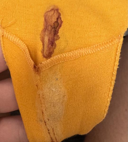 Bild zu Einnistung? - Kinderwunsch - bitte noch ein Baby