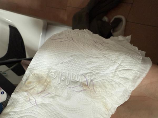 Bild zu Ist das eine Einnistungsblutung? Achtung mit Bild? - Kinderwunsch - bitte noch ein Baby