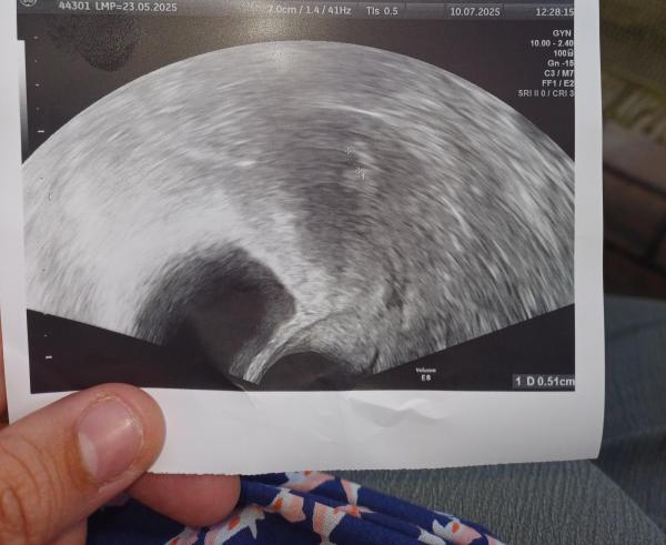 Bild zu Ssw7 - Kinderwunsch - bitte noch ein Baby