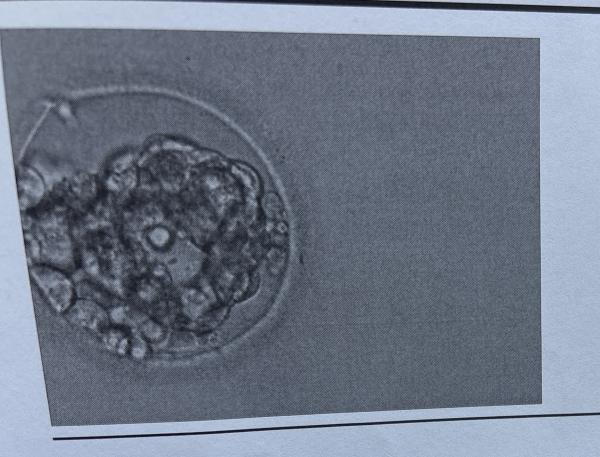 Bild zu Kryo Transfer Blasto hilfee - Kinderwunsch - bitte noch ein Baby