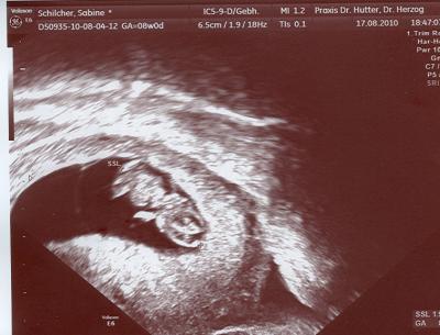 Bild zu Alles super! - Kinderwunschbehandlung