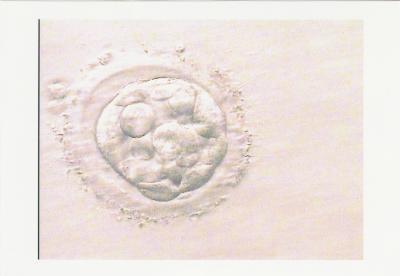 Bild zu 1.IVF gescheitert. Bin sehr entmutigt!!! - Kinderwunschbehandlung