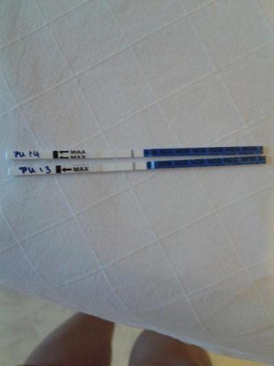 Bild zu SST - Könnt ihr mal schauen? - Kinderwunschbehandlung