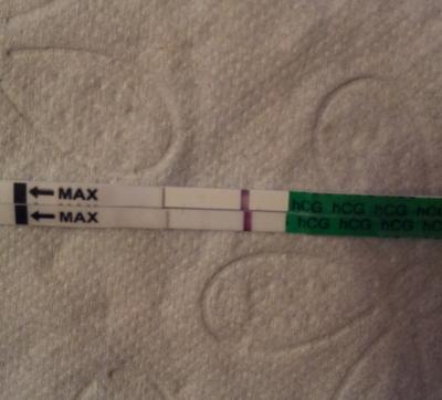 Bild zu SST - Kinderwunschbehandlung