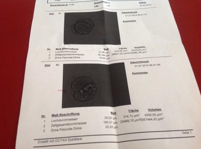 Bild zu Heute war mein Kryotransfer! - Kinderwunschbehandlung