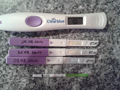 Bild zu Endlich auslösen - Kinderwunschbehandlung