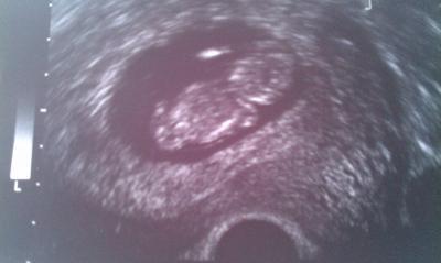 Bild zu @ all - Kinderwunschbehandlung