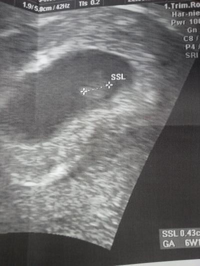 Bild zu FA-Termin - Kinderwunschbehandlung