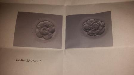 Bild zu 1.Ivf versuch bin ganz hibblig - Kinderwunschbehandlung