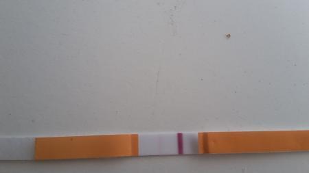 Bild zu Erste Icsi - Kinderwunschbehandlung