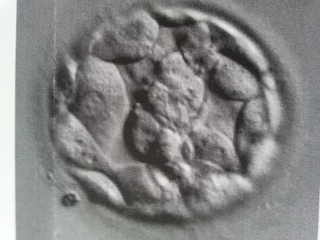 Bild zu was sagt ihr zu diesem Blasto?? - Kinderwunschbehandlung