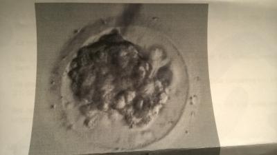 Bild zu Tf+2 - Kinderwunschbehandlung