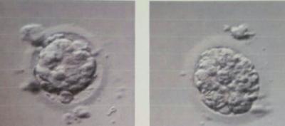 Bild zu Blastozysten Transfer - Kinderwunschbehandlung