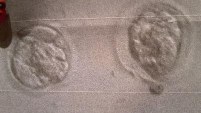 Bild zu Schaut mal bitte - eure Meinungen sind gefragt!!! - Kinderwunschbehandlung